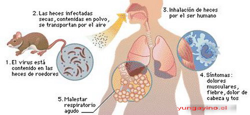 Virus Hanta en Yungay